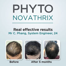 PROMOTIONAL PACK Phytonovathrix Global Anti-Hair loss Treatment 24x3.5ml (2x12 -50% in the 2nd unit value)
